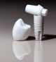 Zirconia Dental Implants option in Colorado Springs