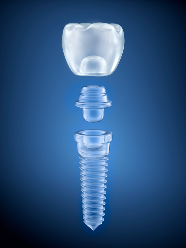 The benefits of Zirconia Dental Implants