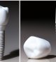The Rise of Zirconia Dental Implants: A Preferred Choice Among Dentists